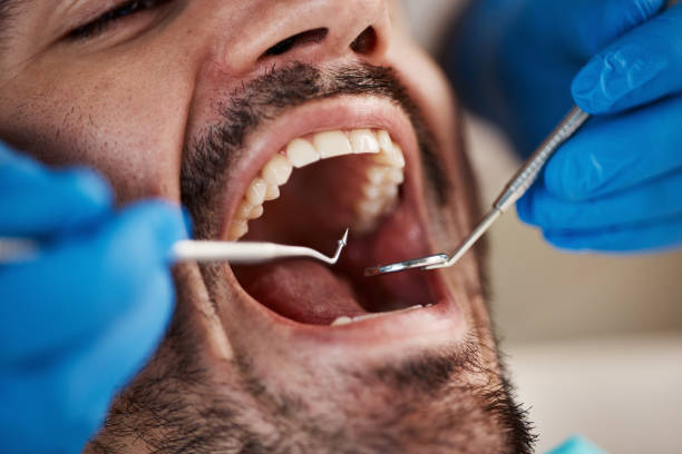 Best Emergency Dental Care for Abscessed Tooth in Red Cloud, NE